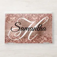 Rose Gold Glitter Foil Fancy Monogram HP Laptop Skin