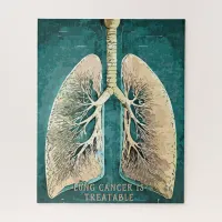 Human Lungs Jigsaw Puzzle