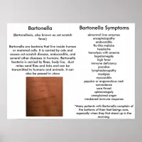 Bartonella Symptoms Educational Poster