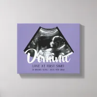 Sonogram Keepsake Baby Ultrasound Canvas Print