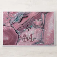 Girly Rose Gold Pink Agate Quartz Sparkle Monogram HP Laptop Skin