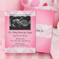 Ultrasound and Lace Baby Shower Invitation