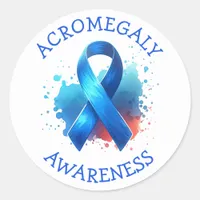 Acromegaly Awareness Ribbon Classic Round Sticker