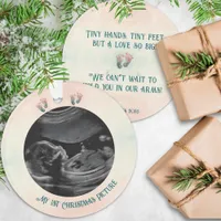 Baby Ultrasound 1st Christmas Expecting Ornament