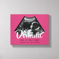 Sonogram Keepsake Baby Ultrasound Canvas Print